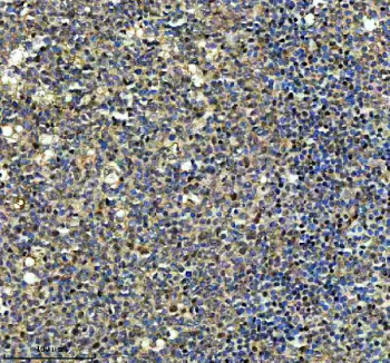 Immunohistochemical staining of NCAPG using anti-NCAPG antibody. NCAPG was detected in a paraffin-embedded section of human tonsil tissue. Heat mediated antigen retrieval was performed in EDTA buffer (pH 8.0, epitope retrieval solution). The tissue section was blocked with 10% goat serum. The tissue section was then incubated with 2 ug/ml rabbit anti-NCAPG antibody overnight at 4oC. Peroxidase Conjugated Goat Anti-rabbit IgG was used as secondary antibody and incubated for 30 minutes at 37oC. The tissue section was developed using an HRP secondary and DAB substrate.