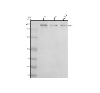 Western blot analysis of Tuberin/TSC2 (Phospho-S939) using anti-Phospho-Tuberin (pSer939) antibody. Electrophoresis was performed on a 8% SDS-PAGE gel at 80V (Stacking gel) / 120V (Resolving gel) for 2 hours. Lane 1: human PC-3 whole cell lysates, Lane 2: human SIHA whole cell lysates, Lane 3: human MCF-7 whole cell lysates. After electrophoresis, proteins were transferred to a nitrocellulose membrane at 150 mA for 50-90 minutes. Blocked the membrane with 5% non-fat milk/TBS for 1.5 hour at RT. The membrane was incubated with rabbit anti-Tuberin/TSC2 (Phospho-S939) antibody at a dilution of 1:500 overnight at 4oC, then washed with TBS-0.1%Tween 3 times with 5 minutes each and probed with a goat anti-rabbit IgG-HRP secondary antibody at a dilution of 1:5000 for 1.5 hour at RT. The signal was developed using an ECL Plus Western Blotting Substrate. A band is detected just below the 250 kDa marker, consistent with the known slower migration of hyperphosphorylated TSC2 relative to its ~201 kDa predicted mass. The upper mobility reflects multi-site phosphorylation of TSC2 and compression of large proteins on an 8% gel.