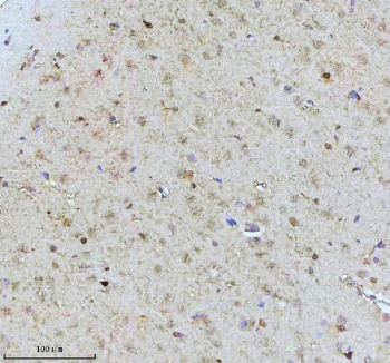 Immunohistochemical staining of Tuberin/TSC2 (Phospho-S939) using anti-Phospho-Tuberin (pSer939) antibody. Tuberin/TSC2 (Phospho-S939) was detected in a paraffin-embedded section of rat brain tissue. Heat mediated antigen retrieval was performed in EDTA buffer (pH 8.0, epitope retrieval solution). The tissue section was blocked with 10% goat serum. The tissue section was then incubated with a dilution of 1:50 rabbit anti-Phospho-Tuberin (Ser939) antibody overnight at 4oC. Peroxidase Conjugated Goat Anti-rabbit IgG was used as secondary antibody and incubated for 30 minutes at 37oC. The tissue section was developed using an HRP secondary and DAB substrate.