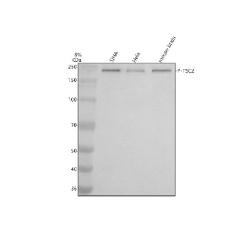 Western blot analysis of Tuberin/TSC2 using anti-Tuberin/TSC2 antibody. Electrophoresis was performed on a 8% SDS-PAGE gel at 80V (Stacking gel) / 120V (Resolving gel) for 2 hours. Lane 1: human SH-SY5Y whole cell lysates, Lane 2: human SIHA whole cell lysates, Lane 3: human Hela whole cell lysates, Lane 4: human 293T whole cell lysates. After electrophoresis, proteins were transferred to a nitrocellulose membrane at 150 mA for 50-90 minutes. Blocked the membrane with 5% non-fat milk/TBS for 1.5 hour at RT. The membrane was incubated with rabbit anti-Tuberin/TSC2 antibody at 1:500 overnight at 4oC, then washed with TBS-0.1%Tween 3 times with 5 minutes each and probed with a goat anti-rabbit IgG-HRP secondary antibody at a dilution of 1:5000 for 1.5 hour at RT. The signal was developed using an ECL Plus Western Blotting Substrate. A band is detected just below the 250 kDa marker, consistent with the known slower migration of hyperphosphorylated TSC2 relative to its ~201 kDa predicted mass. The upper mobility reflects multi-site phosphorylation of TSC2 and compression of large proteins on an 8% gel.