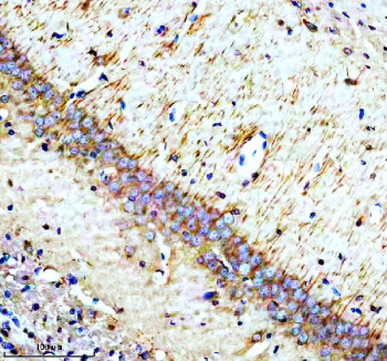 Immunohistochemical staining of Synaptotagmin-10/SYT10 using anti-SYT10 antibody. Synaptotagmin-10/SYT10 was detected in a paraffin-embedded section of rat brain tissue. Heat mediated antigen retrieval was performed in EDTA buffer (pH 8.0, epitope retrieval solution). The tissue section was blocked with 10% goat serum. The tissue section was then incubated with 2 ug/ml rabbit anti-SYT10 antibody overnight at 4oC. Peroxidase Conjugated Goat Anti-rabbit IgG was used as secondary antibody and incubated for 30 minutes at 37oC. The tissue section was developed using an HRP secondary and DAB substrate.