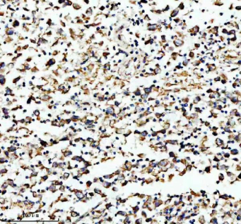 Immunohistochemical staining of HADHA using anti-HADHA antibody. HADHA was detected in a paraffin-embedded section of human testis cancer tissue. Heat mediated antigen retrieval was performed in EDTA buffer (pH 8.0, epitope retrieval solution). The tissue section was blocked with 10% goat serum. The tissue section was then incubated with 2 ug/ml rabbit anti-HADHA antibody overnight at 4oC. Peroxidase Conjugated Goat Anti-rabbit IgG was used as secondary antibody and incubated for 30 minutes at 37oC. The tissue section was developed using an HRP secondary and DAB substrate.