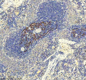 Immunohistochemical staining of GLIPR2 using anti-GLIPR2 antibody. GLIPR2 was detected in a paraffin-embedded section of rat spleen tissue. Heat mediated antigen retrieval was performed in EDTA buffer (pH 8.0, epitope retrieval solution). The tissue section was blocked with 10% goat serum. The tissue section was then incubated with 2 ug/ml rabbit anti-GLIPR2 antibody overnight at 4oC. Peroxidase Conjugated Goat Anti-rabbit IgG was used as secondary antibody and incubated for 30 minutes at 37oC. The tissue section was developed using an HRP secondary and DAB substrate.