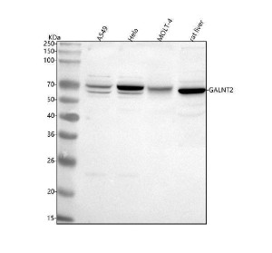 GALNT2 Antibody Human, Mouse and Rat WB. Western blot analysis using GALNT2 Antibody. Lane 1: human A549 cells; Lane 2: human HeLa cells; Lane 3: human MOLT-4 cells; Lane 4: rat liver tissue lysate. A specific band is detected at approximately 65 kDa in all samples, consistent with the expected molecular weight of GALNT2. The broad expression observed across human cell lines and rat liver tissue is consistent with the widespread distribution of this Golgi-resident glycosyltransferase, which initiates mucin-type O-linked glycosylation of numerous membrane and secreted proteins. These results support the use of GALNT2 Antibody / O-Glycosylation Enzyme Antibody for studying GALNT2 expression, protein O-glycosylation and Golgi-associated protein processing.
