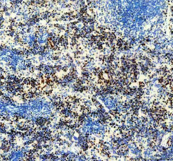 Ki-67 Antibody Clone 31K02 / MKI67 Antibody Clone 31K02. Immunohistochemistry analysis of paraffin-embedded mouse spleen tissue using Ki-67 antibody clone 31K02. Strong nuclear brown staining is observed in numerous proliferating lymphoid cells within splenic white pulp regions, consistent with the known expression pattern of Ki-67 / MKI67 in actively dividing cells. Surrounding cells with lower proliferative activity show comparatively weaker staining. Heat-induced antigen retrieval was performed in EDTA buffer (pH 8.0) prior to staining. The tissue section was incubated with Ki-67 antibody clone 31K02 followed by peroxidase-conjugated goat anti-rabbit IgG secondary antibody, and signal was visualized using an HRP detection system with DAB chromogenic substrate.