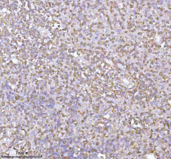 Immunohistochemical staining of PLBD2 using anti-PLBD2 antibody. PLBD2 was detected in a paraffin-embedded section of human spleen tissue. Heat mediated antigen retrieval was performed in EDTA buffer (pH 8.0, epitope retrieval solution). The tissue section was blocked with 10% goat serum. The tissue section was then incubated with 2 ug/ml rabbit anti-PLBD2 antibody overnight at 4oC. Peroxidase Conjugated Goat Anti-rabbit IgG was used as secondary antibody and incubated for 30 minutes at 37oC. The tissue section was developed using an HRP secondary and DAB substrate.
