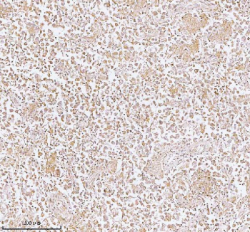 Immunohistochemical staining of PLBD2 using anti-PLBD2 antibody. PLBD2 was detected in a paraffin-embedded section of human testicular seminoma tissue. Heat mediated antigen retrieval was performed in EDTA buffer (pH 8.0, epitope retrieval solution). The tissue section was blocked with 10% goat serum. The tissue section was then incubated with 2 ug/ml rabbit anti-PLBD2 antibody overnight at 4oC. Peroxidase Conjugated Goat Anti-rabbit IgG was used as secondary antibody and incubated for 30 minutes at 37oC. The tissue section was developed using an HRP secondary and DAB substrate.