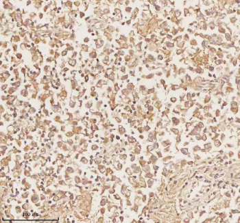 Immunohistochemical staining of PLBD2 using anti-PLBD2 antibody. PLBD2 was detected in a paraffin-embedded section of human testicular seminoma tissue. Heat mediated antigen retrieval was performed in EDTA buffer (pH 8.0, epitope retrieval solution). The tissue section was blocked with 10% goat serum. The tissue section was then incubated with 2 ug/ml rabbit anti-PLBD2 antibody overnight at 4oC. Peroxidase Conjugated Goat Anti-rabbit IgG was used as secondary antibody and incubated for 30 minutes at 37oC. The tissue section was developed using an HRP secondary and DAB substrate.