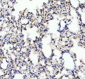 GPRC5A Antibody Rat Lung IHC. Immunohistochemistry analysis of FFPE rat lung tissue using GPRC5A Antibody. Heat induced antigen retrieval was performed in pH 8.0 EDTA buffer prior to overnight incubation with primary antibody (2 ug/mL) at 4Â°C. Peroxidase-conjugated goat anti-rabbit IgG and DAB chromogen were used for visualization. Predominantly membranous staining is observed in alveolar and bronchiolar epithelial cells, consistent with the localization of GPRC5A as a retinoic acid-inducible orphan G protein-coupled receptor expressed in pulmonary epithelium. These results support the use of GPRC5A Antibody / Retinoic Acid Inducible GPCR Antibody for studying GPRC5A expression, epithelial GPCR biology and lung homeostasis.