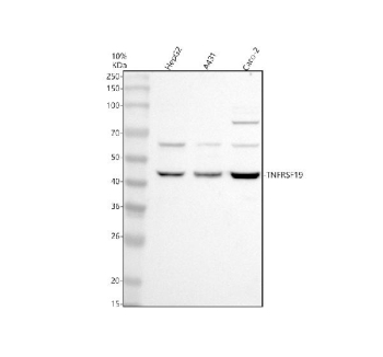Western blot analysis of TNFRSF19 using anti-TNFRSF19 antibody. Electrophoresis was performed on a 10% SDS-PAGE gel at 80V (Stacking gel) / 120V (Resolving gel) for 2 hours. Lane 1: human HepG2 whole cell lysates, Lane 2: human whole cell lysates, Lane 3: human Caco-2 whole cell lysates. After electrophoresis, proteins were transferred to a nitrocellulose membrane at 150 mA for 50-90 minutes. Blocked the membrane with 5% non-fat milk/TBS for 1.5 hour at RT. The membrane was incubated with rabbit anti-TNFRSF19 antibody at 0.5 ug/ml overnight at 4oC, then washed with TBS-0.1%Tween 3 times with 5 minutes each and probed with a goat anti-rabbit IgG-HRP secondary antibody at a dilution of 1:5000 for 1.5 hour at RT. The signal was developed using an ECL Plus Western Blotting Substrate. A main band is detected at ~46 kDa as expected, with consistent higher bands at ~55-65 kDa and ~90-100 kDa. These upper species are consistent with differential N-glycosylation and disulfide-linked receptor dimers commonly observed for TNF receptor family members.