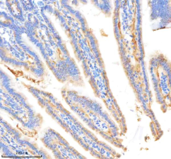 Immunohistochemical staining of BDKRB2 using anti-BDKRB2 antibody. BDKRB2 was detected in a paraffin-embedded section of mouse small intestine tissue. Heat mediated antigen retrieval was performed in EDTA buffer (pH 8.0, epitope retrieval solution). The tissue section was blocked with 10% goat serum. The tissue section was then incubated with 1:200 rabbit anti-BDKRB2 antibody overnight at 4oC. Peroxidase Conjugated Goat Anti-rabbit IgG was used as secondary antibody and incubated for 30 minutes at 37oC. The tissue section was developed using an HRP secondary and DAB substrate.