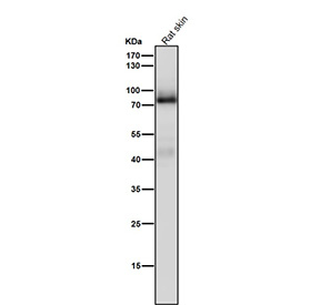 Western blot testing of rat skin tissue lysate using the Pan-PKC antibody at 1:5000 dilution for 1 hour at room temperature.