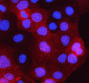 Immunofluorescent staining of STARD10 using anti-STARD10 antibody (red). STARD10 was detected in an immunocytochemical section of CACO-2 cells. Enzyme antigen retrieval was performed using IHC enzyme antigen retrieval reagent for 15 mins. The cells were blocked with 10% goat serum. And then incubated with 5 ug/ml rabbit anti-STARD10 antibody overnight at 4oC. Cy3 Conjugated Goat Anti-Rabbit IgG was used as secondary antibody at 1:500 dilution and incubated for 30 minutes at 37oC. The section was counterstained with DAPI nuclear stain (blue). Visualize using a fluorescence microscope and filter sets appropriate for the label used.