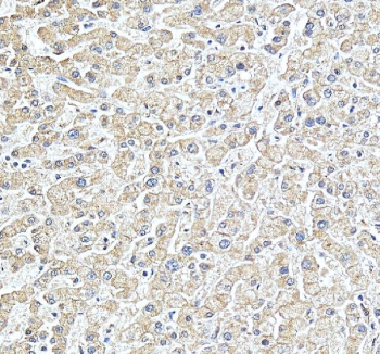 Immunohistochemical staining of STARD10 using anti-STARD10 antibody. STARD10 was detected in a paraffin-embedded section of human liver tissue. Heat mediated antigen retrieval was performed in EDTA buffer (pH 8.0, epitope retrieval solution). The tissue section was blocked with 10% goat serum. The tissue section was then incubated with 2 ug/ml rabbit anti-STARD10 antibody overnight at 4oC. Peroxidase Conjugated Goat Anti-rabbit IgG was used as secondary antibody and incubated for 30 minutes at 37oC. The tissue section was developed using an HRP secondary and DAB substrate.