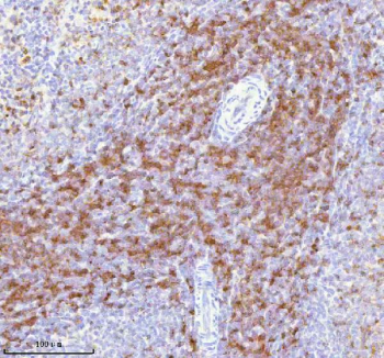 Immunohistochemical staining of Lat using anti-Lat antibody. Lat was detected in a paraffin-embedded section of rat spleen tissue. Heat mediated antigen retrieval was performed in EDTA buffer (pH 8.0, epitope retrieval solution). The tissue section was blocked with 10% goat serum. The tissue section was then incubated with 2 ug/ml rabbit anti-Lat antibody overnight at 4oC. Peroxidase Conjugated Goat Anti-rabbit IgG was used as secondary antibody and incubated for 30 minutes at 37oC. The tissue section was developed using an HRP secondary and DAB substrate.