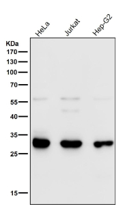 VAPA Antibody Human Cell Line WB. Western blot analysis of human HeLa, Jurkat, and HepG2 cell lysates using VAPA Antibody / Vesicle-Associated Membrane Protein-Associated Protein A demonstrates a prominent band at approximately 28-33 kDa, consistent with the predicted molecular weight of VAPA. Additional weaker bands observed in some samples may represent alternative isoforms, post-translationally modified forms, or minor cross-reactive species. VAPA is an endoplasmic reticulum-associated membrane protein involved in intracellular trafficking, membrane contact site formation, lipid transport, and organelle communication. The observed expression across multiple human cell lines supports application of this antibody for Western blot detection of VAPA in human cellular systems. Antibody incubation was performed at a 1:1000 dilution for 1 hour at room temperature.