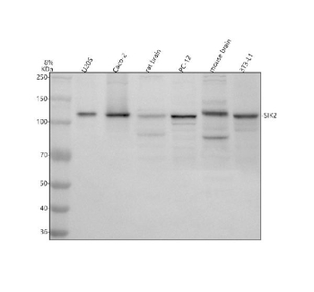 Western blot analysis of SIK2 using anti-SIK2 antibody. Electrophoresis was performed on a 8% SDS-PAGE gel at 80V (Stacking gel) / 120V (Resolving gel) for 2 hours. Lane 1: human U2OS whole cell lysates, Lane 2: human Caco-2 whole cell lysates, Lane 3: rat brain tissue lysates, Lane 4: rat PC-12 whole cell lysates, Lane 5: mouse brain tissue lysates, Lane 6: mouse 3T3-L1 whole cell lysates. After electrophoresis, proteins were transferred to a nitrocellulose membrane at 150 mA for 50-90 minutes. Blocked the membrane with 5% non-fat milk/TBS for 1.5 hour at RT. The membrane was incubated with rabbit anti-SIK2 antibody at 0.5 ug/ml overnight at 4oC, then washed with TBS-0.1%Tween 3 times with 5 minutes each and probed with a goat anti-rabbit IgG-HRP secondary antibody at a dilution of 1:5000 for 1.5 hour at RT. The signal was developed using an ECL Plus Western Blotting Substrate. A predominant band is detected at ~120 kDa, higher than the ~104 kDa prediction. The slower migration is consistent with multi-site phosphorylation of SIK2 (including LKB1-dependent activation and PKA sites), which produces an apparent mass of ~115-125 kDa on SDS-PAGE.