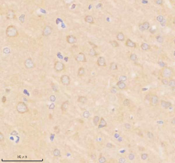 Immunohistochemical staining of SIK2 using anti-SIK2 antibody. SIK2 was detected in a paraffin-embedded section of rat brain tissue. Heat mediated antigen retrieval was performed in EDTA buffer (pH 8.0, epitope retrieval solution). The tissue section was blocked with 10% goat serum. The tissue section was then incubated with 2 ug/ml rabbit anti-SIK2 antibody overnight at 4oC. Peroxidase Conjugated Goat Anti-rabbit IgG was used as secondary antibody and incubated for 30 minutes at 37oC. The tissue section was developed using an HRP secondary and DAB substrate.