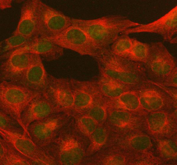 PARP1 Antibody U2OS Cell IF. Immunofluorescent staining of PARP1 using anti-PARP1 antibody (green) and anti-Beta Tubulin antibody (red). PARP1 was detected in immunocytochemical section of U2OS cell. Enzyme antigen retrieval was performed using IHC enzyme antigen retrieval reagent for 15 mins. The cells were blocked with 10% goat serum. And then incubated with 5 ug/ml rabbit anti-PARP1 antibody and mouse anti-Beta Tubulin antibody overnight at 4oC. DyLight 488 Conjugated Goat Anti-Rabbit IgG and Cy3 Conjugated Goat Anti-Mouse IgG were used as secondary antibody at 1:500 dilution and incubated for 30 minutes at 37oC. Visualize using a fluorescence microscope and filter sets appropriate for the label used.