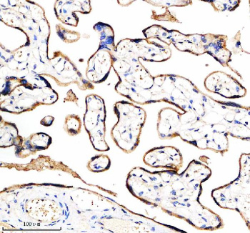 Immunohistochemical staining of ADAM12 using anti-ADAM12 antibody. ADAM12 was detected in a paraffin-embedded section of human placenta tissue. Heat mediated antigen retrieval was performed in EDTA buffer (pH 8.0, epitope retrieval solution). The tissue section was blocked with 10% goat serum. The tissue section was then incubated with 1:100 rabbit anti-ADAM12 antibody overnight at 4oC. Peroxidase Conjugated Goat Anti-rabbit IgG was used as secondary antibody and incubated for 30 minutes at 37oC. The tissue section was developed using an HRP secondary and DAB substrate.
