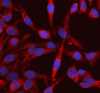Immunofluorescent staining of RIG using anti-RIG antibody (red). RIG was detected in an immunocytochemical section of HELA cells. Enzyme antigen retrieval was performed using IHC enzyme antigen retrieval reagent for 15 mins. The cells were blocked with 10% goat serum. And then incubated with 5 ug/ml rabbit anti-DKK3 antibody overnight at 4oC. Cy3 Conjugated Goat Anti-Rabbit IgG was used as secondary antibody at 1:500 dilution and incubated for 30 minutes at 37oC. The section was counterstained with DAPI nuclear stain (blue). Visualize using a fluorescence microscope and filter sets appropriate for the label used.