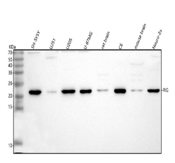 Western blot analysis of RIG using anti-RIG antibody. Lane 1: human SH-SY5Y whole cell lysates, Lane 2: human U251 whole cell lysates, Lane 3: human U20S whole cell lysates, Lane 4: human U-87MG whole cell lysates, Lane 5: rat brain tissue lysates, Lane 6: rat C6 whole cell lysates, Lane 7: mouse brain tissue lysates, Lane 8: mouse Neuro-2a whole cell lysates. After electrophoresis, proteins were transferred to a nitrocellulose membrane at 150 mA for 50-90 minutes. Blocked the membrane with 5% non-fat milk/TBS for 1.5 hour at RT. The membrane was incubated with rabbit anti-DKK3 antibody at 0.5 ug/ml overnight at 4oC, then washed with TBS-0.1%Tween 3 times with 5 minutes each and probed with a goat anti-rabbit IgG-HRP secondary antibody at a dilution of 1:5000 for 1.5 hour at RT. The signal was developed using enhanced chemiluminescent. Western blot analysis of putative protein RIG using anti-RIG antibody. A single band is detected at ~22 kDa in multiple lysates, running above the ~12 kDa prediction. The higher apparent MW is consistent with the known anomalous SDS-PAGE migration of this small hydrophobic protein and its partial oligomer/membrane association; it is distinct from RIG-I (DDX58).