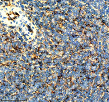 Immunohistochemical staining of ICAM1 using anti-ICAM1 antibody. ICAM1 was detected in a paraffin-embedded section of mouse spleen tissue. Heat mediated antigen retrieval was performed in EDTA buffer (pH 8.0, epitope retrieval solution). The tissue section was blocked with 10% goat serum. The tissue section was then incubated with 1:50 rabbit anti-ICAM1 antibody overnight at 4oC. Peroxidase Conjugated Goat Anti-rabbit IgG was used as secondary antibody and incubated for 30 minutes at 37oC. The tissue section was developed using an HRP secondary and DAB substrate.
