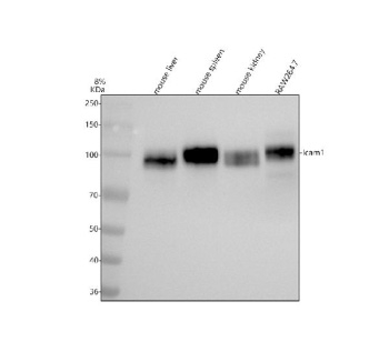 Western blot analysis of ICAM1 using anti-ICAM1 antibody. Electrophoresis was performed on a 8% SDS-PAGE gel at 80V (Stacking gel) / 120V (Resolving gel) for 2 hours. Lane 1: mouse liver tissue lysates, Lane 2: mouse spleen tissue lysates, Lane 3: mouse kidney tissue lysates, Lane 4: mouse RAW264.7 whole cell lysates. After electrophoresis, proteins were transferred to a nitrocellulose membrane at 150 mA for 50-90 minutes. Blocked the membrane with 5% non-fat milk/TBS for 1.5 hour at RT. The membrane was incubated with rabbit anti-ICAM1 antibody at 1:500 overnight at 4oC, then washed with TBS-0.1%Tween 3 times with 5 minutes each and probed with a goat anti-rabbit IgG-HRP secondary antibody at a dilution of 1:5000 for 1.5 hour at RT. The signal was developed using an ECL Plus Western Blotting Substrate. Predicted molecular weight: ~58 kDa (unmodified), 75-115 kDa (glycosylated).