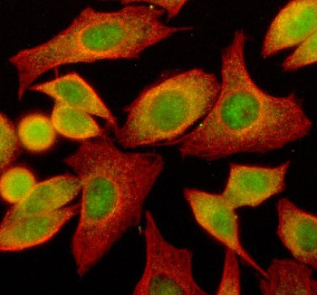 STING1 Antibody Rabbit Polyclonal for IF immunofluorescence analysis of human cells. Immunofluorescent staining of human SiHa cells using STING1 Antibody Rabbit Polyclonal for IF demonstrates cytoplasmic fluorescence consistent with intracellular localization of Stimulator of interferon genes protein / STING1 (TMEM173). STING1 signal is visualized in green using DyLight 488-conjugated secondary antibody, while Beta Tubulin staining appears red following detection with Cy3-conjugated secondary antibody, highlighting the cytoskeletal network. Cells were blocked with 10% goat serum and incubated with rabbit anti-STING1 antibody (5 ug/ml) together with mouse anti-Beta Tubulin antibody overnight at 4oC. Following secondary antibody incubation, fluorescence signals were visualized by microscopy using filter sets appropriate for the fluorescent labels.
