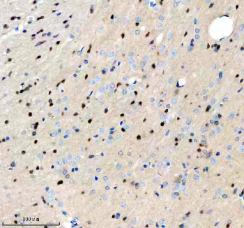 Immunohistochemical staining of PIP5K1A using anti-PIP5K1A antibody. PIP5K1A was detected in a paraffin-embedded section of rat brain tissue. Heat mediated antigen retrieval was performed in EDTA buffer (pH 8.0, epitope retrieval solution). The tissue section was blocked with 10% goat serum. The tissue section was then incubated with 2 ug/ml rabbit anti-PIP5K1A antibody overnight at 4oC. Peroxidase Conjugated Goat Anti-rabbit IgG was used as secondary antibody and incubated for 30 minutes at 37oC. The tissue section was developed using an HRP secondary and DAB substrate.
