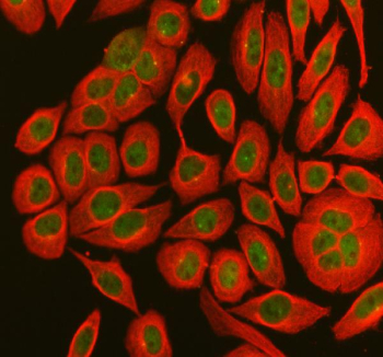 MX1 Antibody Nuclear Localization IF. Immunofluorescent staining of SiHa cells using MX1 Antibody / Antiviral Response Protein Antibody demonstrates strong green fluorescence predominantly localized within the nucleus and perinuclear compartment. Alpha Tubulin is visualized in red, highlighting the cytoskeletal network, while MX1 staining reveals expression of the interferon-inducible antiviral response protein. MX1 (Myxovirus Resistance Protein 1) is a dynamin-like GTPase that functions downstream of interferon signaling pathways and contributes to innate immune defense by restricting viral replication and supporting host antiviral responses. The observed staining pattern is consistent with the intracellular localization of MX1 and supports the utility of this antibody for immunofluorescent detection of antiviral response pathways and interferon-regulated proteins. Enzyme-mediated antigen retrieval was performed for 15 minutes prior to overnight primary antibody incubation and fluorescent secondary antibody detection.