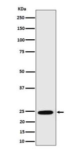 Western blot analysis of RalA in human MCF7 cell lysate using RALA antibody. Predicted molecular weight ~24 kDa.
