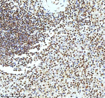Immunohistochemical staining of Histone H3 using anti-Histone H3 antibody. Histone H3 was detected in a paraffin-embedded section of human spleen tissue. Heat mediated antigen retrieval was performed in EDTA buffer (pH 8.0, epitope retrieval solution). The tissue section was blocked with 10% goat serum. The tissue section was then incubated with 2 ug/ml rabbit anti-Histone H3 antibody overnight at 4oC. Peroxidase Conjugated Goat Anti-rabbit IgG was used as secondary antibody and incubated for 30 minutes at 37oC. The tissue section was developed using an HRP secondary and DAB substrate.