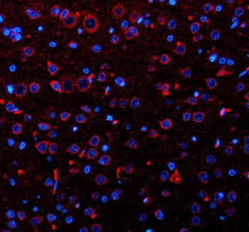Immunofluorescent staining of OPN3 using anti-OPN3 antibody. OPN3 was detected in a paraffin-embedded section of rat brain tissue. Heat mediated antigen retrieval was performed in EDTA buffer (pH 8.0, epitope retrieval solution). The tissue section was blocked with 10% goat serum. The tissue section was then incubated with 5 ug/ml rabbit anti-OPN3 antibody overnight at 4oC. Cy3 Conjugated Goat Anti-Rabbit IgG was used as secondary antibody at 1:500 dilution and incubated for 30 minutes at 37oC. The section was counterstained with DAPI nuclear stain (blue). Visualize using a fluorescence microscope and filter sets appropriate for the label used.