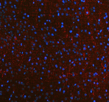 NEFM Antibody Mouse Brain IF. Immunofluorescent staining of FFPE mouse brain tissue using NEFM Antibody. Heat-induced epitope retrieval was performed in pH 8.0 EDTA buffer prior to incubation with the primary antibody at 5 ug/mL overnight at 4Â°C. A Cy3-conjugated goat anti-rabbit secondary antibody (red) was used for detection, and nuclei were counterstained with DAPI (blue). Bright red fluorescence highlights neuronal cell bodies and an extensive network of neuronal processes throughout the brain tissue, consistent with the expected distribution of neurofilament medium chain within the neuronal cytoskeleton. These results demonstrate that NEFM Antibody, a Neuronal Cytoskeletal Marker Antibody, specifically detects endogenous neurofilament medium chain in FFPE mouse brain tissue.