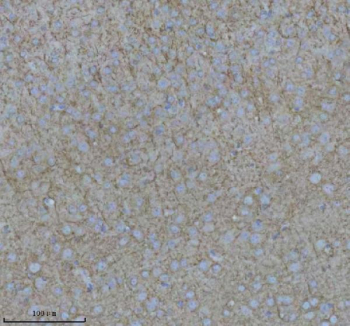 NEFM Antibody Mouse Brain IHC. Immunohistochemical staining of FFPE mouse brain tissue using NEFM Antibody. Heat-induced epitope retrieval was performed in pH 8.0 EDTA buffer prior to incubation with the primary antibody at 2 ug/mL overnight at 4Â°C. An HRP-conjugated goat anti-rabbit secondary antibody with DAB chromogen was used for visualization. Diffuse cytoplasmic staining is observed throughout neurons in the brain parenchyma, consistent with the expected distribution of neurofilament medium chain within the neuronal cytoskeleton. These results demonstrate that NEFM Antibody, a Neuronal Cytoskeletal Marker Antibody, specifically detects endogenous neurofilament medium chain in FFPE mouse brain tissue.