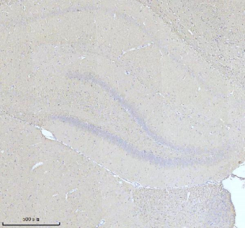 Immunohistochemical staining of NF-M/NEFM using anti-NEFM antibody. NF-M/NEFM was detected in a paraffin-embedded section of rat brain tissue. Heat mediated antigen retrieval was performed in EDTA buffer (pH 8.0, epitope retrieval solution). The tissue section was blocked with 10% goat serum. The tissue section was then incubated with 2 ug/ml rabbit anti-NEFM antibody overnight at 4oC. Peroxidase Conjugated Goat Anti-rabbit IgG was used as secondary antibody and incubated for 30 minutes at 37oC. The tissue section was developed using an HRP secondary and DAB substrate.