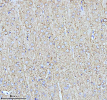 NEFM Antibody Rat Brain IHC. Immunohistochemical staining of FFPE rat brain tissue using NEFM Antibody. Heat-induced epitope retrieval was performed in pH 8.0 EDTA buffer prior to incubation with the primary antibody at 2 ug/mL overnight at 4Â°C. An HRP-conjugated goat anti-rabbit secondary antibody with DAB chromogen was used for visualization. Widespread cytoplasmic staining is observed in neurons throughout the brain, with prominent labeling of neuronal cell bodies and processes, consistent with the expected distribution of neurofilament medium chain within the neuronal cytoskeleton. These results demonstrate that NEFM Antibody, a Neuronal Cytoskeletal Marker Antibody, specifically detects endogenous neurofilament medium chain in FFPE rat brain tissue.