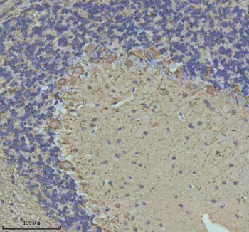 NEFM Antibody Rat Cerebellum IHC. Immunohistochemical staining of FFPE rat cerebellum tissue using NEFM Antibody. Heat-induced epitope retrieval was performed in pH 8.0 EDTA buffer prior to incubation with the primary antibody at 2 ug/mL overnight at 4Â°C. An HRP-conjugated goat anti-rabbit secondary antibody with DAB chromogen was used for visualization. Prominent cytoplasmic staining is observed in Purkinje neurons and their processes at the interface between the molecular and granular layers, consistent with the expected distribution of neurofilament medium chain within the neuronal cytoskeleton. These results demonstrate that NEFM Antibody, a Neuronal Cytoskeletal Marker Antibody, specifically detects endogenous neurofilament medium chain in FFPE rat cerebellum tissue.