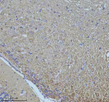 NEFM Antibody Mouse Cerebellum IHC. Immunohistochemical staining of FFPE mouse cerebellum tissue using NEFM Antibody. Heat-induced epitope retrieval was performed in pH 8.0 EDTA buffer prior to incubation with the primary antibody at 2 ug/mL overnight at 4Â°C. An HRP-conjugated goat anti-rabbit secondary antibody with DAB chromogen was used for visualization. Strong cytoplasmic staining is observed in cerebellar neurons, including prominent labeling of Purkinje cells and their processes, consistent with the expected distribution of neurofilament medium chain within the neuronal cytoskeleton. These results demonstrate that NEFM Antibody, a Neuronal Cytoskeletal Marker Antibody, specifically detects endogenous neurofilament medium chain in FFPE mouse cerebellum tissue.