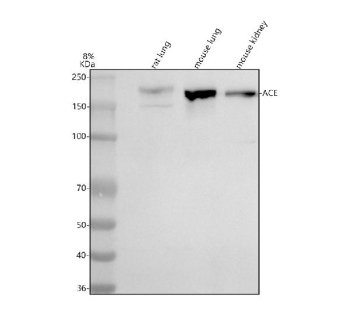 Western blot analysis of ACE using anti-ACE antibody. Lane 1: rat lung tissue lysates, Lane 2: mouse lung tissue lysates, Lane 3: mouse kidney tissue lysates. After electrophoresis, proteins were transferred to a nitrocellulose membrane at 150 mA for 50-90 minutes. Blocked the membrane with 5% non-fat milk/TBS for 1.5 hour at RT. The membrane was incubated with rabbit anti-ACE antibody at 0.5 ug/ml overnight at 4oC, then washed with TBS-0.1%Tween 3 times with 5 minutes each and probed with a goat anti-rabbit IgG-HRP secondary antibody at a dilution of 1:5000 for 1.5 hour at RT. The signal was developed using enhanced chemiluminescent. A specific band was detected for ACE at approximately 140-170 kDa. The expected molecular weight of ACE is ~150 kDa.
