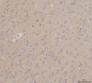 GALC Antibody Mouse Brain IHC. Immunohistochemical staining of FFPE mouse brain tissue using GALC antibody at 2 ug/ml following heat-induced epitope retrieval in pH8 EDTA buffer. Detection was performed using an HRP-conjugated secondary antibody with DAB chromogen. GALC immunoreactivity is observed throughout the brain parenchyma with predominantly cytoplasmic staining in neural cells, consistent with the lysosomal localization of Galactocerebrosidase, an essential enzyme involved in galactolipid metabolism and myelin maintenance. This result demonstrates that the GALC Antibody / Galactocerebrosidase Antibody is suitable for immunohistochemical detection of endogenous GALC in formalin-fixed, paraffin-embedded mouse tissue.
