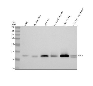 MYL2 Antibody by WB in Cardiac and Skeletal Muscle Western blot testing of MYL2 Antibody at 0.5 ug/ml with human heart (lane 1), human skeletal muscle (lane 2), monkey heart (lane 3), rat heart (lane 4), mouse heart (lane 5) and mouse skeletal muscle (lane 6) lysates. This Myosin Regulatory Light Chain 2 Polyclonal Antibody detects a prominent band at approximately 19 kDa across the tested samples, consistent with the expected molecular weight of MYL2. Detection in human, monkey, rat and mouse lysates supports recognition of the target across multiple species.