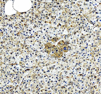 EIF2A Antibody Pancreas IHC. Immunohistochemistry analysis of FFPE human pancreas tissue stained with EIF2A antibody detecting Eukaryotic initiation factor 2A. Cytoplasmic staining is observed in pancreatic cells with moderate intensity and a granular distribution, consistent with EIF2A localization in ribosome-associated translation machinery and involvement in non-canonical protein synthesis. The staining highlights both exocrine and endocrine cellular compartments, with nuclei counterstained blue. HIER: heat-mediated antigen retrieval in pH 8 EDTA buffer.
