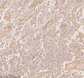 Immunohistochemical staining of SSSCA1/ZNRD2 using anti-ZNRD2 antibody. SSSCA1/ZNRD2 was detected in a paraffin-embedded section of human testicular seminoma tissue. Heat mediated antigen retrieval was performed in EDTA buffer (pH 8.0, epitope retrieval solution). The tissue section was blocked with 10% goat serum. The tissue section was then incubated with 2 ug/ml rabbit anti-ZNRD2 antibody overnight at 4oC. Peroxidase Conjugated Goat Anti-rabbit IgG was used as secondary antibody and incubated for 30 minutes at 37oC. The tissue section was developed using an HRP secondary and DAB substrate.