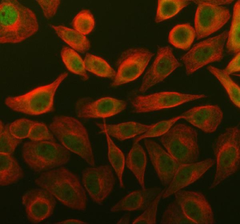 Immunofluorescent staining of UBE2F using anti-UBE2F antibody (green) and anti-Alpha Tubulin antibody (red). UBE2F was detected in an immunocytochemical section of SiHa cells. Enzyme antigen retrieval was performed using IHC enzyme antigen retrieval reagent for 15 mins. The cells were blocked with 10% goat serum. And then incubated with 5 ug/ml rabbit anti-UBE2F antibody and mouse anti-Beta Tubulin antibody overnight at 4oC. DyLight 488 Conjugated Goat Anti-Rabbit IgG and Cy3 Conjugated Goat Anti-Mouse IgG were used as secondary antibody at 1:500 dilution and incubated for 30 minutes at 37oC. Visualize using a fluorescence microscope and filter sets appropriate for the label used.