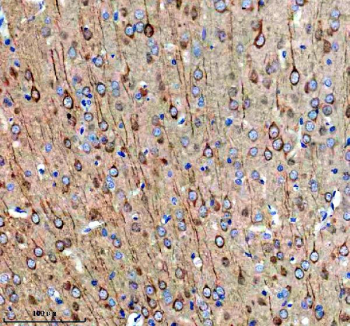 Immunohistochemical staining of MAP1B using anti-MAP1B antibody. MAP1B was detected in a paraffin-embedded section of rat brain tissue. Heat mediated antigen retrieval was performed in EDTA buffer (pH 8.0, epitope retrieval solution). The tissue section was blocked with 10% goat serum. The tissue section was then incubated with 2 ug/ml rabbit anti-MAP1B antibody overnight at 4oC. Peroxidase Conjugated Goat Anti-rabbit IgG was used as secondary antibody and incubated for 30 minutes at 37oC. The tissue section was developed using an HRP secondary and DAB substrate.