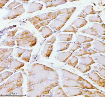 Immunohistochemical staining of PFKM using anti-PFKM antibody. PFKM was detected in a paraffin-embedded section of rat skeletal muscle tissue. Heat mediated antigen retrieval was performed in EDTA buffer (pH 8.0, epitope retrieval solution). The tissue section was blocked with 10% goat serum. The tissue section was then incubated with 2 ug/ml rabbit anti-PFKM antibody overnight at 4oC. Peroxidase Conjugated Goat Anti-rabbit IgG was used as secondary antibody and incubated for 30 minutes at 37oC. The tissue section was developed using an HRP secondary and DAB substrate.