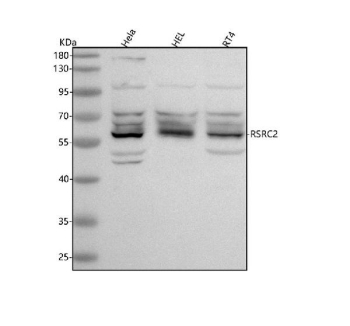 Western blot analysis of RSRC2 using anti-RSRC2 antibody. Lane 1: human Hela whole cell lysates, Lane 2: human HEL whole cell lysates, Lane 3: human RT4 whole cell lysates. After electrophoresis, proteins were transferred to a nitrocellulose membrane at 150 mA for 50-90 minutes. Blocked the membrane with 5% non-fat milk/TBS for 1.5 hour at RT. The membrane was incubated with rabbit anti-RSRC2 antibody at 0.5 ug/ml overnight at 4oC, then washed with TBS-0.1%Tween 3 times with 5 minutes each and probed with a goat anti-rabbit IgG-HRP secondary antibody at a dilution of 1:5000 for 1.5 hour at RT. The signal was developed using enhanced chemiluminescent. RSRC2 antibody detects a predominant band at ~58 kDa in HeLa, HEL, and RT4 lysates, with additional weaker bands above and below. Although the calculated mass is ~51 kDa, RSRC2 is an SR-rich splicing factor whose extensive phosphorylation and splice variation commonly cause slower migration and closely spaced multiplets.
