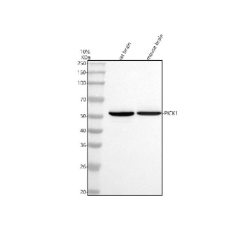 Western blot analysis of PICK1 using anti-PICK1 antibody. Electrophoresis was performed on a 10% SDS-PAGE gel at 80V (Stacking gel) / 120V (Resolving gel) for 2 hours. Lane 1: rat brain tissue lysates, Lane 2: mouse brain tissue lysates. After electrophoresis, proteins were transferred to a nitrocellulose membrane at 150 mA for 50-90 minutes. Blocked the membrane with 5% non-fat milk/TBS for 1.5 hour at RT. The membrane was incubated with rabbit anti-PICK1 antibody at 0.5 ug/ml overnight at 4oC, then washed with TBS-0.1%Tween 3 times with 5 minutes each and probed with a goat anti-rabbit IgG-HRP secondary antibody at a dilution of 1:5000 for 1.5 hour at RT. The signal was developed using an ECL Plus Western Blotting Substrate. The expected molecular weight of PICK1 is ~47 kDa.
